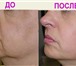 Изображение в Красота и здоровье Косметика Система Skindulgence® - нехирургическая подтяжка в Хабаровске 4 500