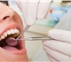 Внимание! Бесплатное лечение зуба только