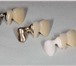 Изображение в Красота и здоровье Стоматологии Установка протезов зубов, протезирование в Калининграде 1