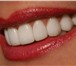 Foto в Красота и здоровье Стоматологии Здоровые,красивые,ровные зубы,-свидетель в Москве 0