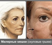 Изображение в Красота и здоровье Массаж Помогу избавиться от скуловых ( малярных в Красноярске 0