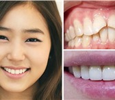 Фото в Красота и здоровье Стоматологии Вас приветствует Государственная стоматологическая в Иркутске 2 000