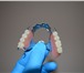 Фотография в Красота и здоровье Стоматологии Установка протезов зубов, протезирование в Калининграде 1