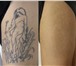 Foto в Красота и здоровье Косметические услуги - Лазерное удаление татуировок и татуажа, в Уфе 0