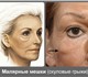 Помогу избавиться от скуловых ( малярных